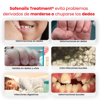 SafeNails® Treatment esmalte natural para evitar comerse las uñas y chuparse los dedos