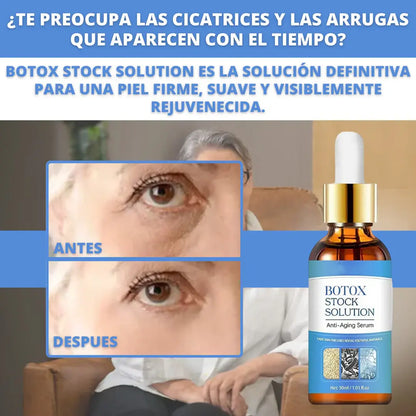 Botox Stock Solution suero antiarrugas